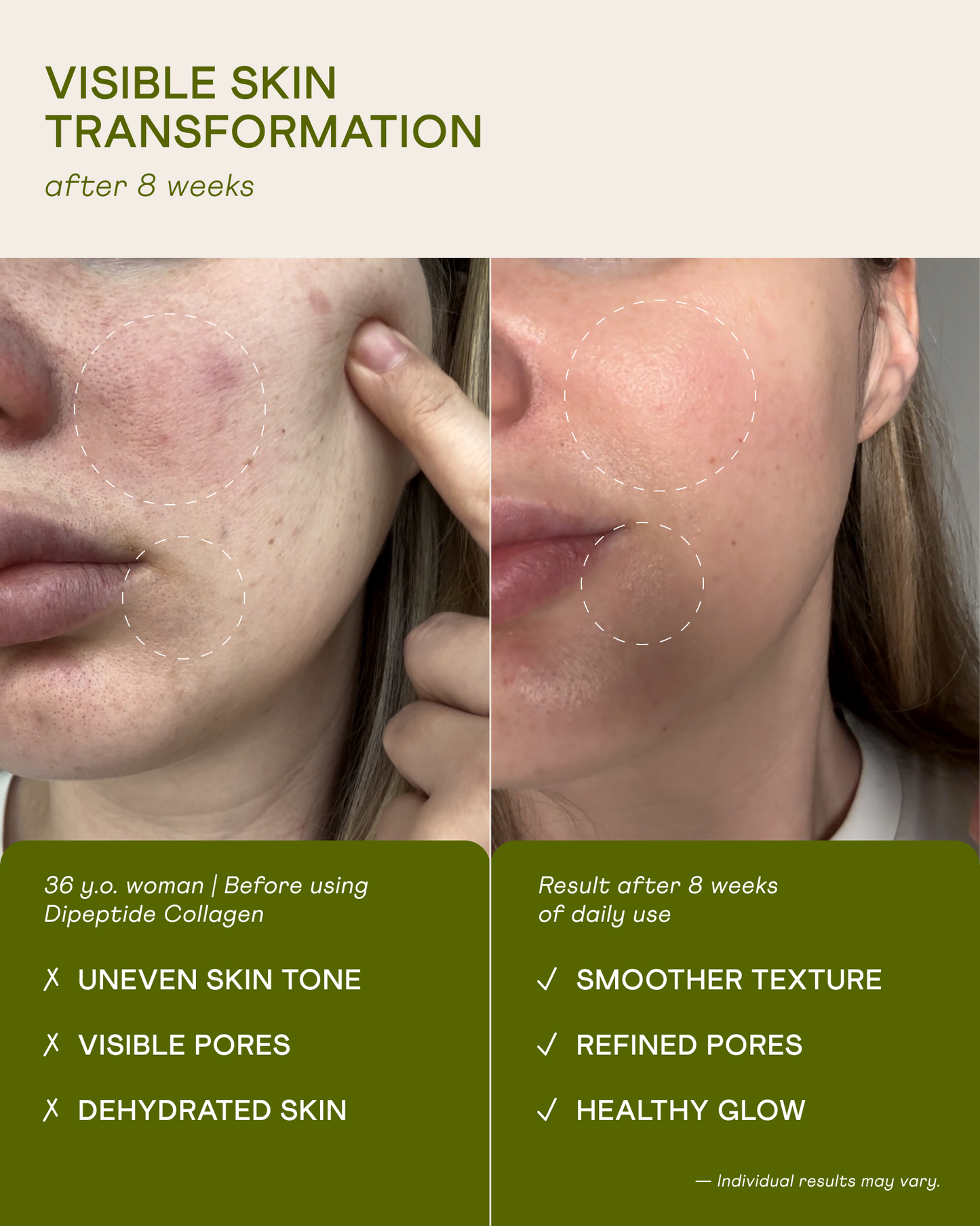 Dipeptide Marine Collagen for Skin, Hair & Nails – Made in Japan