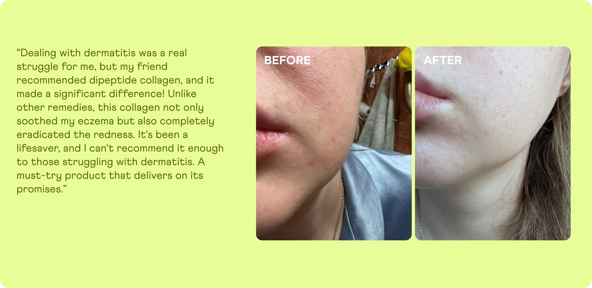 Customer photo review showing improvement in skin quality after taking dipeptide collagen, originally affected by dermatitis